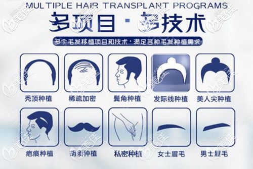 院内植发服务项目齐全 院内植发服务项目齐全