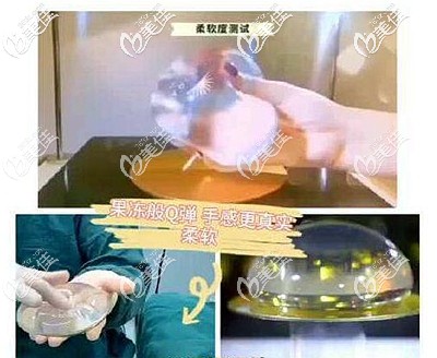 傲诺拉星熠系列假体的优势 傲诺拉星熠系列假体的优势