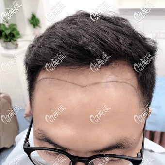 20200414_1586844828550147.jpg 12d7850e03bc4fedd0d0b414a05b6044216900.jpg