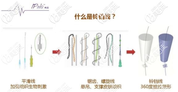 美国铃铛线 美国铃铛线