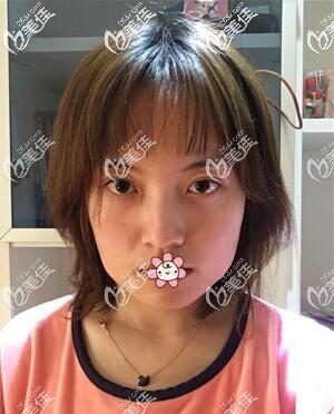 术前的我 术前的我