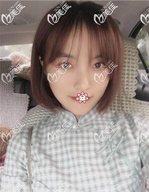 脸真的变小了很多 脸真的变小了很多