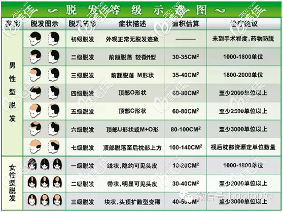 脱发等级的示意图 脱发等级的示意图