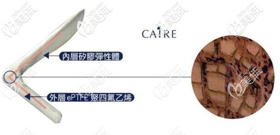 卡麦拉鼻假体 卡麦拉鼻假体