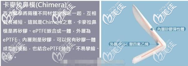 卡麦拉隆鼻假体