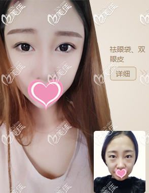 北京画美真人案例图1 北京画美真人案例图1