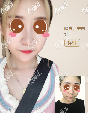 北京画美真人案例图2 北京画美真人案例图2