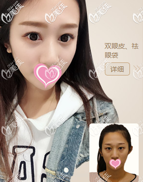 北京画美真人案例图3 北京画美真人案例图3