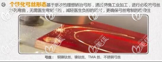 insignia精准正畸个性化弓丝 insignia精准正畸个性化弓丝