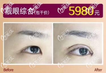 海南华美眼综合真人前后对比案例图 海南华美眼综合真人前后对比案例图