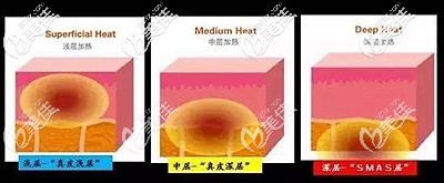 热拉提的主要作用 热拉提的主要作用