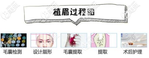 眉毛移植手术过程图 眉毛移植手术过程图