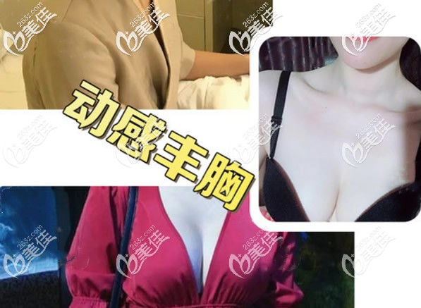 内窥镜双平面隆胸效果案例