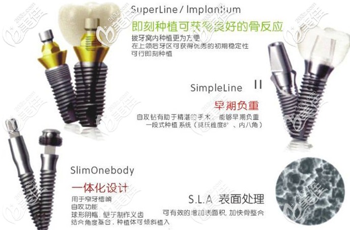 韩国登腾种植体型号的优势