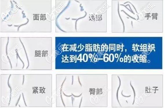 黄金微雕适合的部位 黄金微雕适合的部位