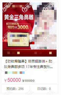 菲思挺膨体隆鼻5万多的价格