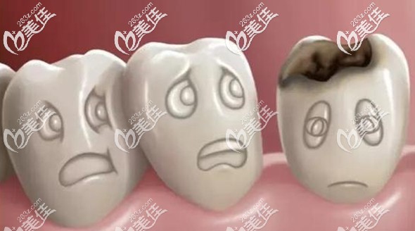 树脂补门牙的弊端就是时间长了会容易变色