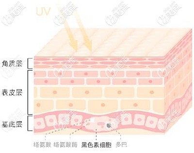 面部斑点的形成原因 面部斑点的形成原因