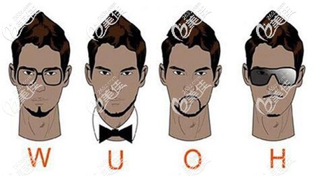 胡须种植分为哪些类型 胡须种植分为哪些类型