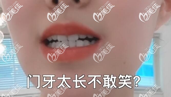 门牙太长怎么矫正 门牙太长怎么矫正