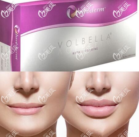 乔雅登VOLBELLA丰唇效果