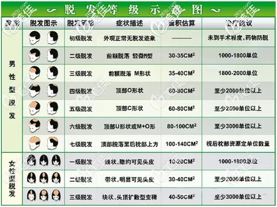 脱发等级示意图