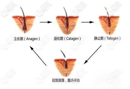 头发生长周期示意图 头发生长周期示意图