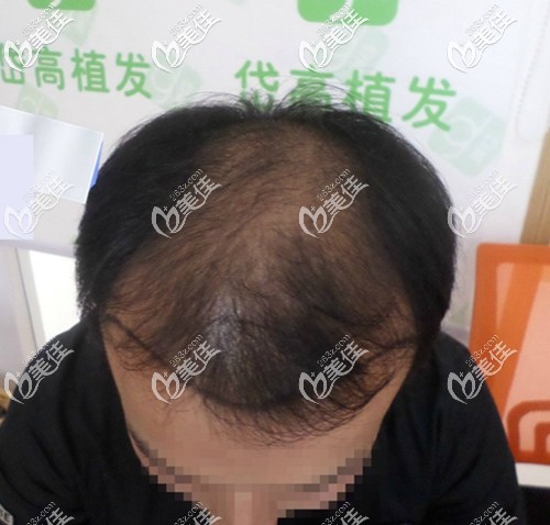 来医院做头发检查面诊 来医院做头发检查面诊