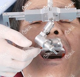 使用电子面弓测量口腔数据 使用电子面弓测量口腔数据