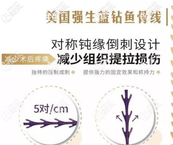 美国强生蓝钻鱼骨线优势