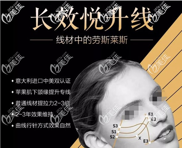 意大利悦升线优势