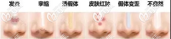 隆鼻失败常见症状