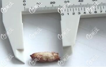 取出的骨粉图片