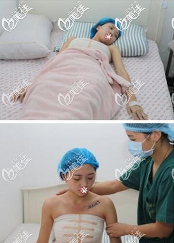 术后三天我还在医院 术后三天我还在医院