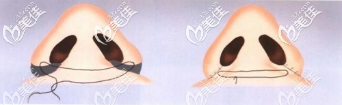 综合治疗原理 综合治疗原理