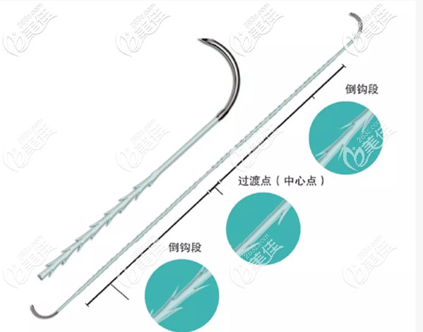 美国快翎线QUILL形状 美国快翎线QUILL形状