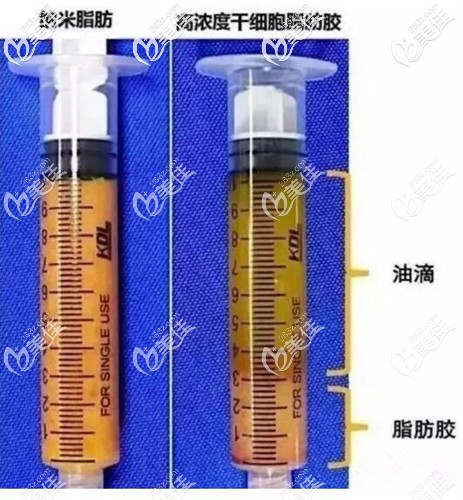 什么是脂肪胶 什么是脂肪胶