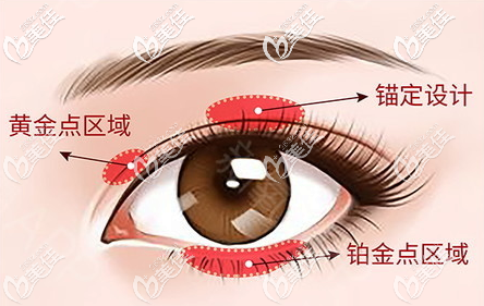 2汕头ido整形医院张贤期医生双眼皮 2汕头ido整形医院张贤期医生双眼皮