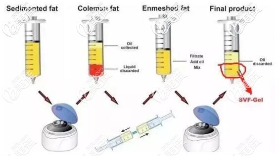 脂肪胶提取过程