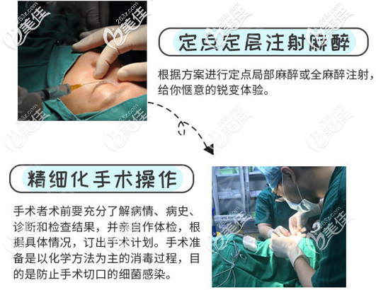 广州佳人李宗磊医生双眼皮手术过程图