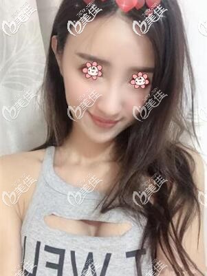 这医院在泰国隆胸还真可以 这医院在泰国隆胸还真可以