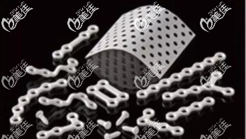 颧骨取钛钉并非是大手术 颧骨取钛钉并非是大手术