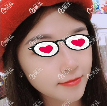 千万别做面部吸脂!我脸部抽脂特别后悔,因为嘴角旁边下垂的两坨肉不见了,哈哈!