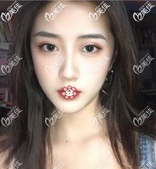 两个月已经超好看了 两个月已经超好看了