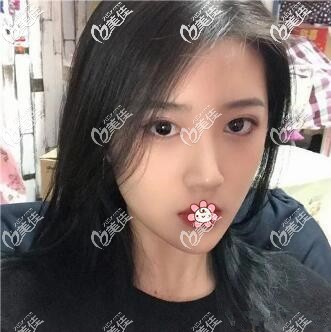 眼睛又大又亮 眼睛又大又亮