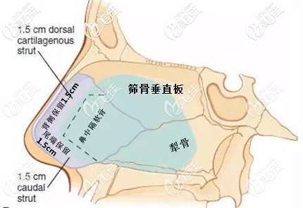 鼻中隔软骨取出的保留量