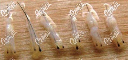 植发手术中提取的毛囊组织 植发手术中提取的毛囊组织