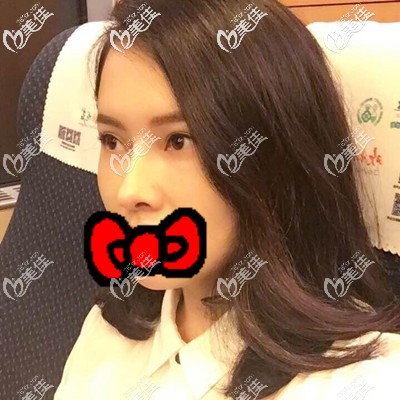 术后一周手术部位还有点肿 术后一周手术部位还有点肿