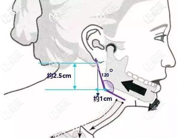 下颌角美学标准 下颌角美学标准
