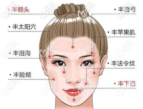 面部脂肪填充的部位